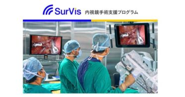 Jmeesと国立がん研究センター東病院共同開発、「内視鏡手術支援プログラムSurVis-Hys」が医療機器としての承認ゲット