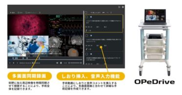 株式会社OPExPARK、手術記録システム「OPeDrive」にAI音声認識搭載で医師の働き方改革
