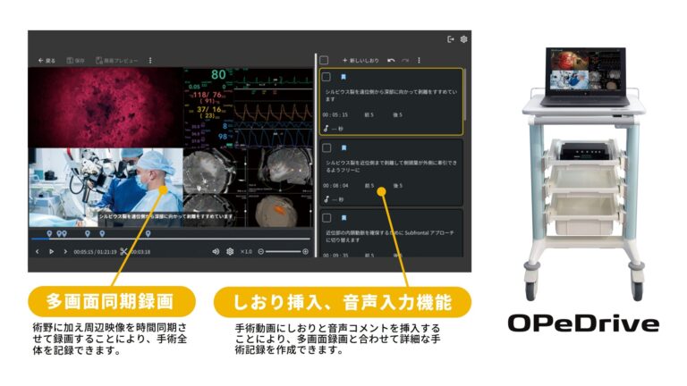 株式会社OPExPARK、手術記録システム「OPeDrive」にAI音声認識搭載で医師の働き方改革