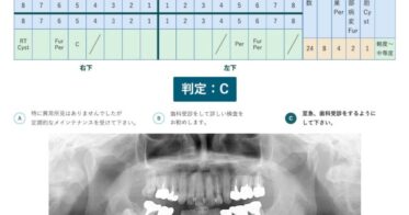 医療法人社団葵会とデンタルシステムズが新たな歯科健診を導入